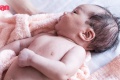 ผดร้อนทารก ผื่นทารก ผื่นขึ้นหน้าทารกต้องดูแลอย่างไรให้หายผดร ...