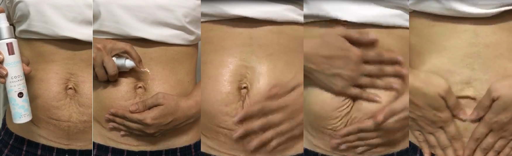 รีวิวโคโคโร่, รีวิวครีมทาแก้ท้องแตกลาย, รีวิวครีมทาท้องแม่ท้อง, รีวิวครีมทาผิวเหี่ยวหลังคลอด, รีวิวครีมทาผิวหลังคลอด, รีวิวโลชั่นทาผิวหลังคลอด, ใช้ครีมอะไรทาแก้ท้องย่นหลังคลอด, ท้องย่นหลังคลอดแก้ยังไง, หน้าท้องย่นหลังคลอดทาครีมอะไรดี, โคโคโร่ดีไหม, โคโคโร่ดีหรือเปล่า, โคโคโร่ คลู คอลลาเจน,Cocoro Cool Collagen,ครีมทาผิวคุณแม่หลังคลอด, ลดท้องย่น ,พุงเหี่ยว