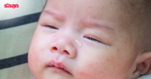 ลูกทารกเป็นท่อน้ำตาตัน ท่อน้ำตาอักเสบ ต้องดูแลอย่างไร