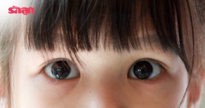 หยิบกล้องขึ้นมา! ถ่ายรูปเด็กตาเป็นแบบนี้ สัญญาณเตือนโรคมะเร็งจอประสาทตาเด็ก