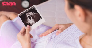 ตั้งครรภ์ 28 วันแรก นาทีทองเพื่อเริ่มสร้างพัฒนาการทางสมองให้ลูก