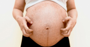 4 ผื่นคันคนท้องที่แม่ท้องต้องรู้และรักษาให้ถูก