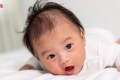 ลูกทารกคอเอียงผิดปกติไหม วิธีแก้และรักษาทารกคอเอียง