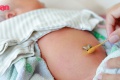 7 ข้อห้ามทำกับสะดือทารก และวิธีทำความสะอาดสะดือทารกที่ถูกต้อ ...