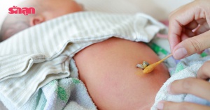 7 ข้อห้ามทำกับสะดือทารก และวิธีทำความสะอาดสะดือทารกที่ถูกต้อง