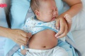 ทารกท้องอืดทำไงดีแม่ สาเหตุอาการทารกท้องอืดพร้อมวิธีนวดแก้อา ...