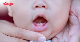 ดูแลฟันลูกตั้งแต่ซี่แรก ช่วยป้องกันฟันผุตั้งแต่เล็ก