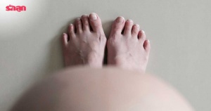 อาการคนท้องเท้าบวม เท้าบวมตอนกี่เดือน พร้อม 10 วิธีแก้อาการคนท้องเท้าบวม