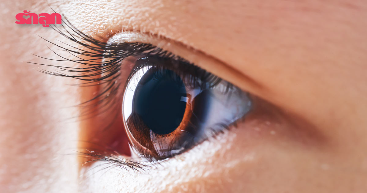 ดวงตา-การดูแลดวงตา- โรคดวงตา- นัยน์ตา- ท่อน้ำตาอุดตัน- สายตาขี้เกียจ- ตาเหล่- ตาเข- ต้อหิน- ต้อกระจก- หนังตาตก- มะเร็งจอประสาทตา