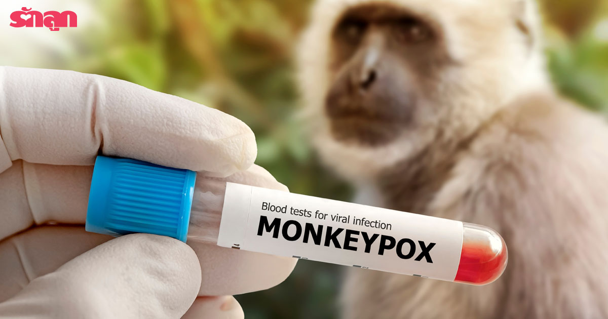 ฝีดาษลิง-โรคฝีดาษลิง-Monkeypox-ไข้ทรพิษ-จะเกิดอะไรขึ้นถ้าเด็กป่วยฝีดาษลิง-ฝีดาษลิงในเด็ก-เด็กป่วยฝีดาษลิง-การฉีดวัคซีนป้องกันโรคไข้ทรพิษ