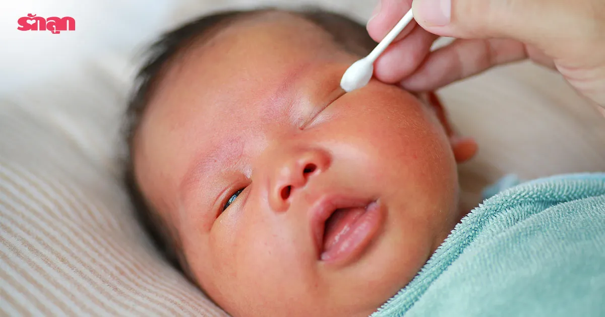 วิธีดูแลเมื่อลูกตาแฉะ