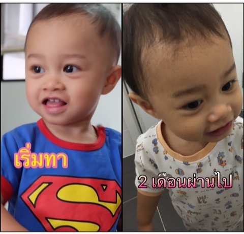 รีวิวยาเพิ่มคิ้วเด็ก, รีวิวยาเร่งคิ้วเด็ก, รีวิวยาปลูกคิ้วเด็ก, รีวิวยาปลูกผมเด็ก, รีวิวยาเร่งผมเด็ก, รีวิว Anthokid, รีวิวแอนโทคิด, เด็กผมน้อย, ผมบาง, ลูกคิ้วบาง, ยาปลูกคิ้ว, ยาปลูกผม, บำรุงคิ้ว, บำรุงผม, อัญชัน ทา คิ้ว, วิธี ทํา ให้ คิ้ว ด ก ด้วย อัญชัน, อัญชัน ทา คิ้ว ทารก, คิ้ว เข้ม ยาเพิ่มคิ้ว ยี่ห้อ ไหน ดี , Anthokid รีวิว, Anthokid พันทิป, Anthokid รีวิว พันทิป, ยาเพิ่มคิ้ว ยี่ห้อ อะไร ดี , Anthokid ราคา, Anthokid ราคาถูก, Anthokid ซื้อ, Anthokid ซื้อ ที่ไหน, ยาเพิ่มคิ้ว อะไร ดี