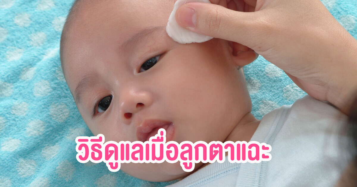 ลูกตาแฉะ, ลูกทารก ตาแฉะ, ทำไม ลูกตาแฉะ, ดูแล ลูกตาแฉะ, รักษา ลูกตาแฉะ, นวดตา ลูกทารก, โรคตาในเด็ก, พัฒนาการทารก