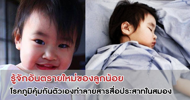 โรคภูมิคุ้มกันตัวเองทำลายสารสื่อประสาทในสมอง,โรคเด็ก,ไม่สบาย,ป่วย,ลูกป่วย,เด็กป่วย,โรคสมอง,สมองเด็ก,Anti-NMDA receptor encephalitis,แม่อ้อมและน้องลาเต้ กับโรค Anti-NMDA receptor encephalitis